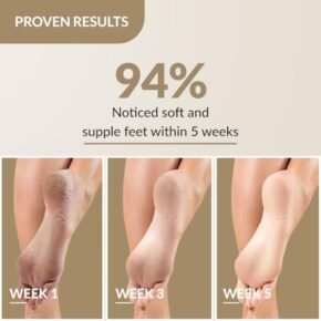 Fixderma Foobetik Cream, Foot cream, Foot Care For Diabetic, For Dry & Cracked Feet, Moisturizes & Soothes Feet, Heel Repair, For Calloused, or Chapped Skin, Paraben Free - 50g - Image 3